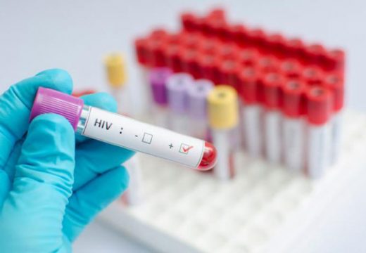 Italijan pozitivan na majmunske boginje, koronu i HIV