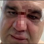 Video: Oglasio se Saša Mirković o pokušaju ubistva