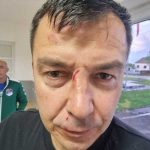 Uhapšene četiri osobe iz Laktaša: Sudiji slomili nos nakon fudbalske utakmice