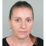 RS: Nestala Ružica Nedinić iz Dervente