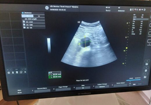 Veliko interesovanje građana za preventivne preglede: Na skriningu trbušne aorte pregledano 109 pacijenata, otkriveno šest aneurizmi