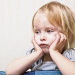 Pedijatar upozorava roditelje “Djecu nikad ne izlažite namjerno ovoj zarazi”