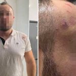 RS: Prva zvanična izjava žrtve policijske brutalnosti u Banjaluci (Foto)