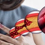 Reagujte na vrijeme: Kako da prepoznate začepljene arterije?