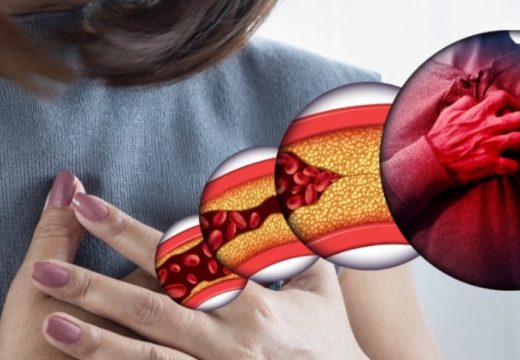 Reagujte na vrijeme: Kako da prepoznate začepljene arterije?