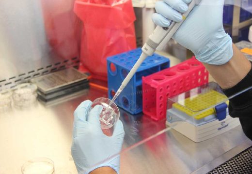 Alarmantno: Otkriven tifus u Srpskoj!