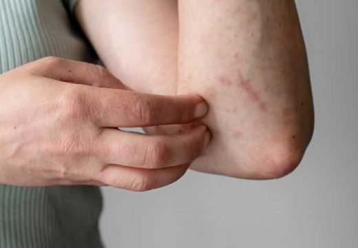 Guba potvrđena u Hrvatskoj: Bolest se pojavila nakon više od 30 godina