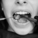 Hronika: Djevojka umrla nakon vađenja umnjaka u Srbiji; Hitno naložena obdukcija