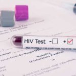 Danas je Svjetski dan borbe protiv AIDS: U 13 gradova organizovano anonimno testiranje