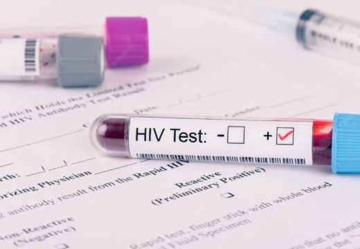 Danas je Svjetski dan borbe protiv AIDS: U 13 gradova organizovano anonimno testiranje