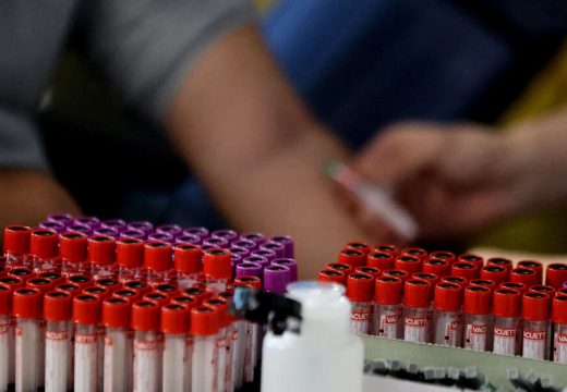 Pokazalo istraživanje: Jedna krvna grupa nosi veći rizik od dijabetesa tipa 2